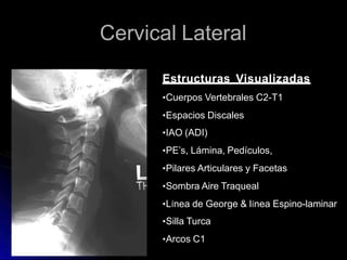 Cervical Lateral
Estructuras Visualizadas
•Cuerpos Vertebrales C2-T1
•Espacios Discales
•IAO (ADI)
•PE’s, Lámina, Pedículos,
•Pilares Articulares y Facetas
•Sombra Aire Traqueal
•Línea de George & línea Espino-laminar
•Silla Turca
•Arcos C1
 