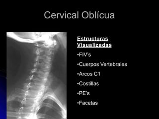 Cervical Oblícua
Estructuras
Visualizadas
•FIV’s
•Cuerpos Vertebrales
•Arcos C1
•Costillas
•PE’s
•Facetas
 