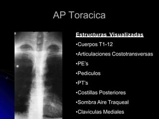 AP Toracica
Estructuras Visualizadas
•Cuerpos T1-12
•Articulaciones Costotransversas
•PE’s
•Pediculos
•PT’s
•Costillas Posteriores
•Sombra Aire Traqueal
•Claviculas Mediales
 
