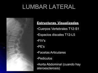 LUMBAR LATERAL
Estructuras Visualizadas
•Cuerpos Vertebrales T12-S1
•Espacios discales T12-L5
•FIV's
•PE's
•Facetas Articulares
•Pediculos
•Aorta Abdominal (cuando hay
ateroesclerosis)
 