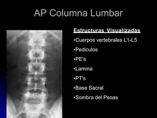 AP Columna Lumbar
Estructuras Visualizadas
•Cuerpos vertebrales L1-L5
•Pediculos
•PE's
•Lamina
•PT's
•Base Sacral
•Sombra del Psoas
 