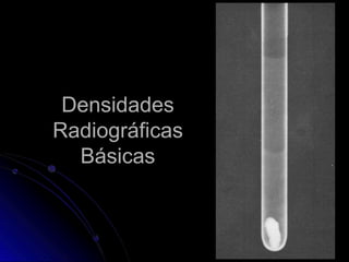 Densidades
Radiográficas
Básicas
 