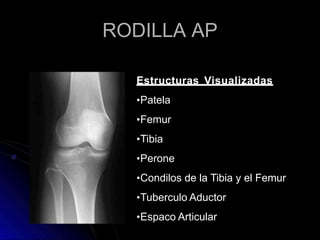 RODILLA AP
Estructuras Visualizadas
•Patela
•Femur
•Tibia
•Perone
•Condilos de la Tibia y el Femur
•Tuberculo Aductor
•Espaco Articular
 