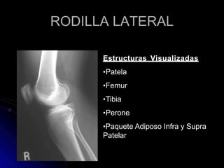 RODILLA LATERAL
Estructuras Visualizadas
•Patela
•Femur
•Tibia
•Perone
•Paquete Adiposo Infra y Supra
Patelar
 