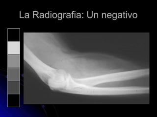 La Radiografia: Un negativo
 