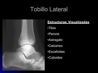 Tobillo Lateral
Estructuras Visualizadas
•Tibia
•Perone
•Astragalo
•Calcaneo
•Escafoides
•Cuboides
 