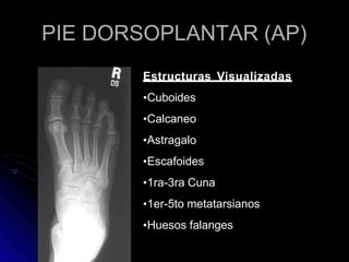 PIE DORSOPLANTAR (AP)
Estructuras Visualizadas
•Cuboides
•Calcaneo
•Astragalo
•Escafoides
•1ra-3ra Cuna
•1er-5to metatarsianos
•Huesos falanges
 