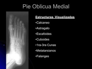 Pie Oblicua Medial
Estructuras Visualizadas
•Calcaneo
•Astragalo
•Escafoides
•Cuboides
•1ra-3ra Cunas
•Metatarsianos
•Falanges
 