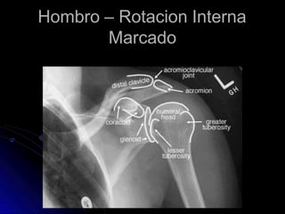 Hombro – Rotacion Interna
Marcado
 