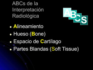 ABCs de la
Interpretación
Radiológica
● Alineamiento
● Hueso (Bone)
● Espacio de Cartílago
● Partes Blandas (Soft Tissue)
CS
AB
 