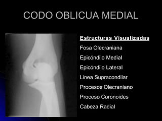 CODO OBLICUA MEDIAL
Estructuras Visualizadas
Fosa Olecraniana
Epicóndilo Medial
Epicóndilo Lateral
Linea Supracondilar
Procesos Olecraniano
Proceso Coronoides
Cabeza Radial
 