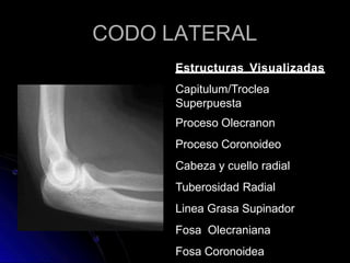 CODO LATERAL
Estructuras Visualizadas
Capitulum/Troclea
Superpuesta
Proceso Olecranon
Proceso Coronoideo
Cabeza y cuello radial
Tuberosidad Radial
Linea Grasa Supinador
Fosa Olecraniana
Fosa Coronoidea
 