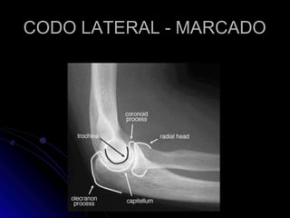 CODO LATERAL - MARCADO
 