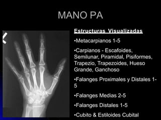 MANO PA
Estructuras Visualizadas
•Metacarpianos 1-5
•Carpianos - Escafoides,
Semilunar, Piramidal, Pisiformes,
Trapezio, Trapezoides, Hueso
Grande, Ganchoso
•Falanges Proximales y Distales 1-
5
•Falanges Medias 2-5
•Falanges Distales 1-5
•Cubito & Estiloides Cubital
 