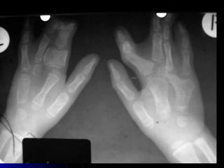 Introducción a la Radiología.pptx