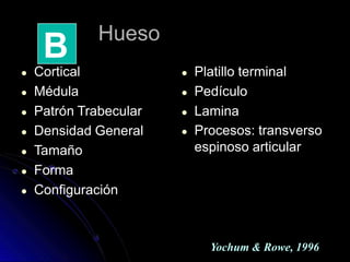 Hueso
● Cortical
● Médula
● Patrón Trabecular
● Densidad General
● Tamaño
● Forma
● Configuración
● Platillo terminal
● Pedículo
● Lamina
● Procesos: transverso
espinoso articular
B
Yochum & Rowe, 1996
 
