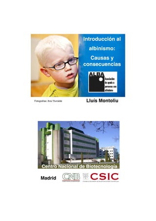 Introducción al
albinismo:
Causas y
consecuencias
Lluís MontoliuFotografías: Ana Yturralde
Madrid
Centro Nacional de Biotecnología
 