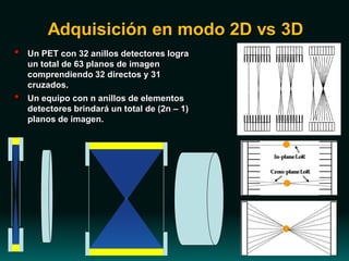 Adquisición en modo 2D vs 3D
• Un PET con 32 anillos detectores logra
un total de 63 planos de imagen
comprendiendo 32 directos y 31
cruzados.
• Un equipo con n anillos de elementos
detectores brindará un total de (2n – 1)
planos de imagen.
 