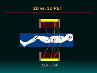 12 3
Axial view
4’’
4’ 4
2D vs. 3D PET
 