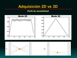 Adquisición 2D vs 3D
Perfil de sensibilidad
Modo 2D Modo 3D
 