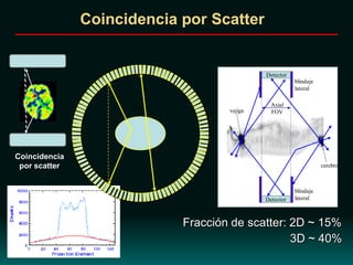 Detector
Detector Side
Shields
Side
Shields
Septa
Septa
Axial
FOV
Coincidencia por Scatter
Coincidencia
por scatter
Detector
Detector
blindaje
lateral
blindaje
lateral
Axial
FOVvejiga
cerebro
Fracción de scatter: 2D ~ 15%
3D ~ 40%
 