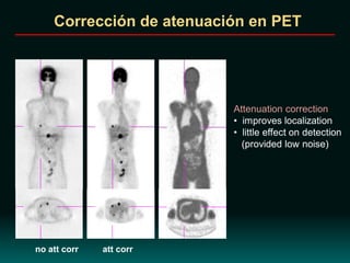 no att corr att corr
Attenuation correction
• improves localization
• little effect on detection
(provided low noise)
Corrección de atenuación en PET
 
