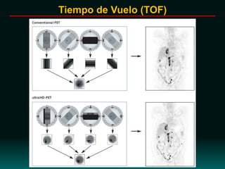 Tiempo de Vuelo (TOF)
 