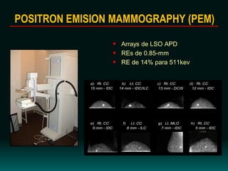  Arrays de LSO APD
 REs de 0.85-mm
 RE de 14% para 511kev
POSITRON EMISION MAMMOGRAPHY (PEM)
 