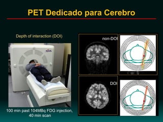 PET Dedicado para Cerebro
100 min past 104MBq FDG injection,
40 min scan
•mrd=54, no span
•DOI Compression
(DOIC)+3DOSEM
(8 sub., 8 iter.)
•1.5mm3 voxel
non-DOI
DOI
Depth of interaction (DOI)
 