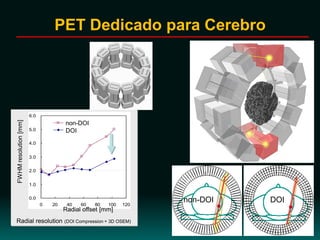 0.0
1.0
2.0
3.0
4.0
5.0
6.0
0 20 40 60 80 100 120
　
　
FWHMresolution[mm]
Radial offset [mm]
non-DOI
DOI
Radial resolution (DOI Compression + 3D OSEM)
non-DOI DOI
PET Dedicado para Cerebro
 