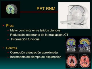 PET-RNM
• Pros
– Mejor contraste entre tejidos blandos
– Reducción importante de la irradiación /CT
– Información funcional
• Contras
– Corrección atenuación aproximada
– Incremento del tiempo de exploración
 