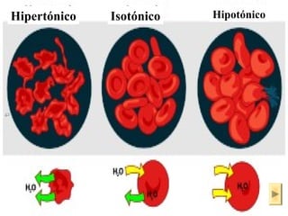 Hipertónico Isotónico Hipotónico 
ISAURA MA. NAVARRET E CU 
 