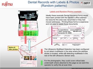 Dental Records with Labels & Photos  (Random patterns) Labels and Random Photos example   Ideally these example Dental Insurance forms would have been printed with the Dentist’s office address but assume this area was not printed or they had moved addresses.  Printing these forms is expensive and not wise to waste these documents Before & after photos Dr. Scott Steiner  License #A287312 1255 E. Arques Ave  408-555-1212 Sunnyvale, CA  94085 The Ultrasonic Multifeed Detection has been configured to not detect multifeeds in the area where the address sticker is located, while still detecting multifeeds in the rest of the left Ultrasonic Sensor area. For the photographs, they could cover critical data underneath where attached to the page so we want the operator to verify this at scan time 