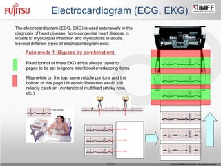 Electrocardiogram (ECG, EKG) Auto mode 1 (Bypass by combination)   The electrocardiogram (ECG, EKG) is used extensively in the diagnosis of heart disease, from congenital heart disease in infants to myocardial infarction and myocarditis in adults. Several different types of electrocardiogram exist . Meanwhile on the top, some middle portions and the bottom of this page Ultrasonic Detection would still reliably catch an unintentional multifeed (sticky note, etc.) Fixed format of three EKG strips always taped to pages to be set to ignore intentional overlapping items 