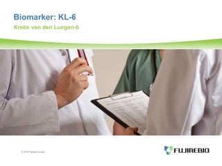 © 2015 Fujirebio Europe
Biomarker: KL-6
Krebs von den Lungen-6
 