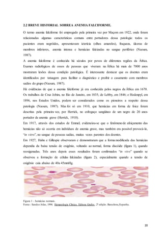 20
2.2 BREVE HISTORIAL SOBREA ANEMIA FALCIFORME.
O termo anemia falciforme foi empregado pela primeira vez por Maçom em 1922, onde foram
relacionadas algumas características comuns entre portadores dessa patologia: todos os
pacientes eram negróides, apresentavam icterícia (olhos amarelos), fraqueza, úlceras de
membros inferiores, anemia intensa e hemácias falcizadas no sangue periférico (Naoum,
1987).
A anemia falciforme é conhecida há séculos por povos de diferentes regiões da África.
Exames radiológicos de ossos de pessoas que viveram na África há mais de 7000 anos
mostraram lesões dessa condição patológica. É interessante destacar que os doentes eram
identificados por tatuagem para facilitar o diagnóstico e proibir o casamento com membros
sadios do grupo (Naoum, 1987).
Há evidências de que a anemia falciforme já era conhecida pelos negros da África em 1670.
Os trabalhos de Cruz Jobim, no Rio de Janeiro, em 1835; de Lebby, em 1846; e Hodenpyl, em
1896, nos Estados Unidos, podem ser considerados como os pioneiros a respeito dessa
patologia (Naoum, 1987). Mas foi só em 1910, que hemácias em forma de foice foram
descritas pela primeira vez, por Herrick, no esfregaço sangüíneo de um negro de 20 anos
portador de anemia grave (Herrick, 1910).
Em 1917, através dos estudos de Emmel, evidenciou-se que o fenômenode afoiçamento das
hemácias não só ocorria em indivíduos de anemia grave, mas também era possível provocá-lo,
“in vitro”, no sangue de pessoas sadias, muitas vezes parentes dos doentes.
Em 1927, Hahn e Gillespie observaram e demonstraram que a forma modificada das hemácias
dependia da baixa tensão de oxigênio, voltando ao normal, forma discóide (figura 1), quando
reoxigenadas. Três anos depois esses resultados foram confirmados “in vivo” quando se
observou a formação de células falcizadas (figura 2), especialmente quando a tensão de
oxigênio caía abaixo de 40a 45mmHg.
Figura 1 – hemácias normais.
Fonte : Sandoz Atlas, 1994. Hematologia Clínica. Editora Grafos, 2ª edição. Barcelona,Espanha.
 