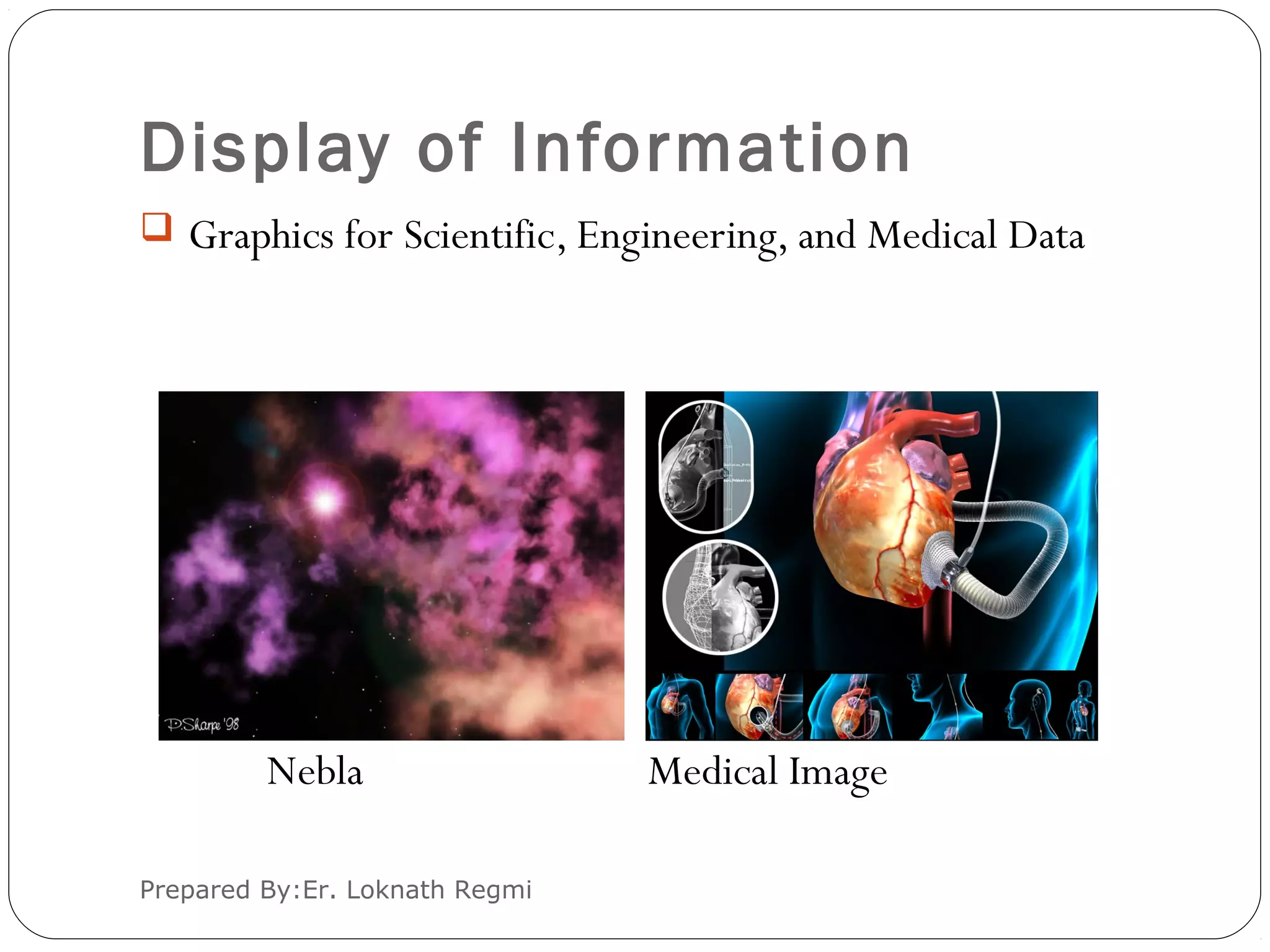 Display of Information
Prepared By:Er. Loknath Regmi
 Graphics for Scientific, Engineering, and Medical Data
Nebla Medical Image
 
