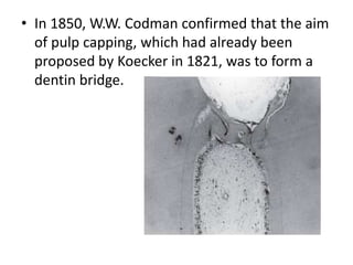 • In 1850, W.W. Codman confirmed that the aim
of pulp capping, which had already been
proposed by Koecker in 1821, was to form a
dentin bridge.
 