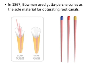 • In 1867, Bowman used gutta-percha cones as
the sole material for obturating root canals.
 