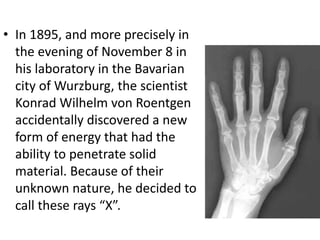 • In 1895, and more precisely in
the evening of November 8 in
his laboratory in the Bavarian
city of Wurzburg, the scientist
Konrad Wilhelm von Roentgen
accidentally discovered a new
form of energy that had the
ability to penetrate solid
material. Because of their
unknown nature, he decided to
call these rays “X”.
 