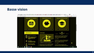 Basse vision
4
 