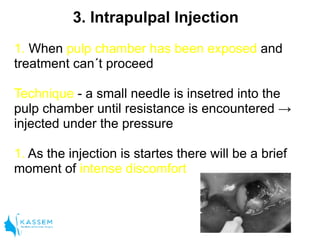 Intrapulpal Introduction to local anaesthesia | PDF