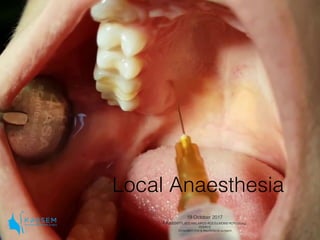 Local Anaesthesia
19 October 2017
I.Kassem,BDS,MSc,MFDS RCS Ed,MOMS RCPS Glasg,
FDSRCS
Consultant Oral & Maxillofacial surgeon
 