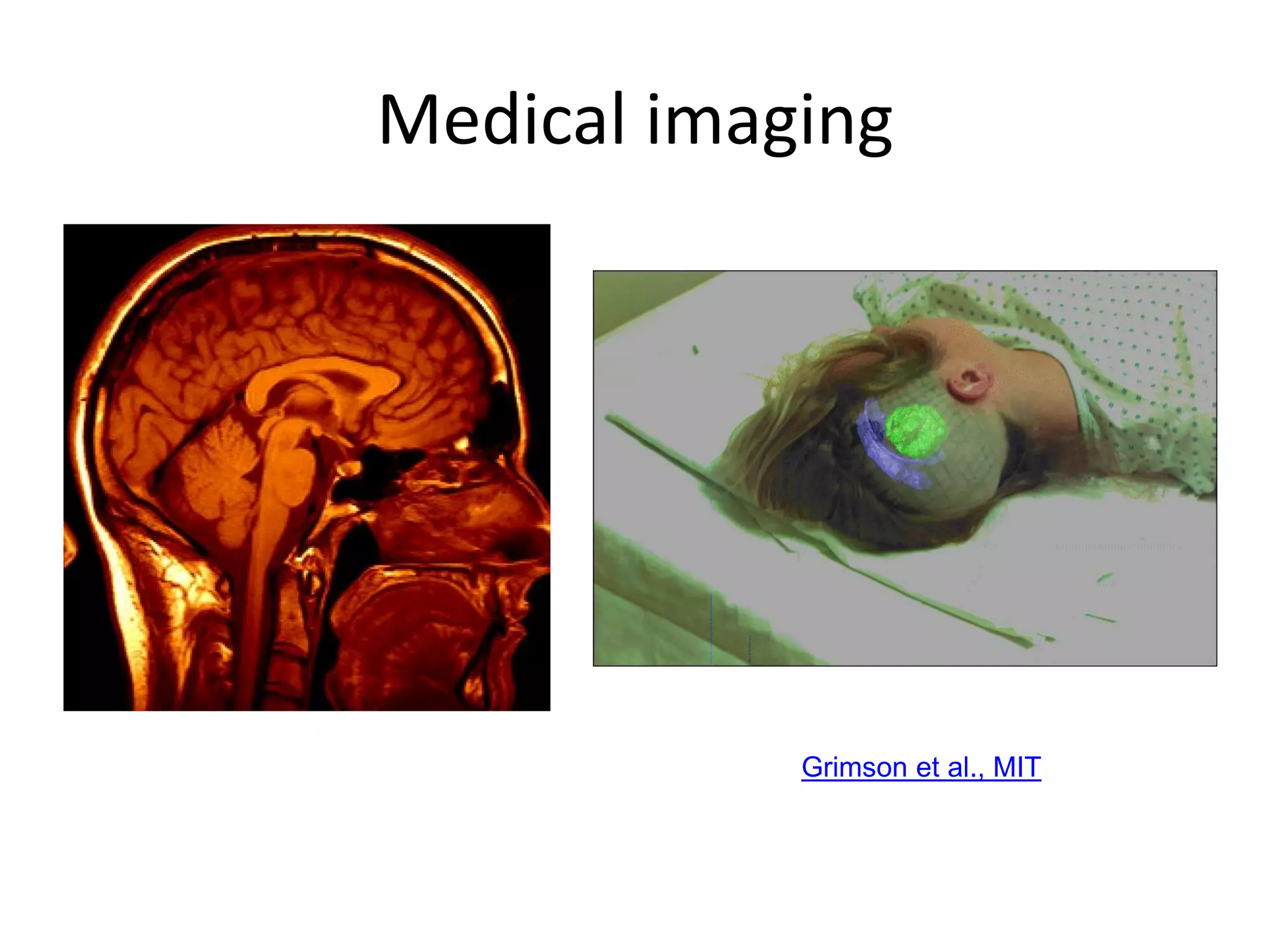 Medical imaging
Image guided surgery
Grimson et al., MIT
3D imaging
MRI, CT
 