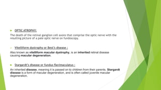  OPTIC ATROPHY:
The death of the retinal ganglion cell axons that comprise the optic nerve with the
resulting picture of a pale optic nerve on fundoscopy.
 Vitelliform dystrophy or Best’s disease :
Also known as vitelliform macular dystrophy, is an inherited retinal disease
causing macular degeneration.
 Stargardt’s disease or fundus ﬂavimaculatus :
An inherited disease, meaning it is passed on to children from their parents. Stargardt
disease is a form of macular degeneration, and is often called juvenile macular
degeneration.
 