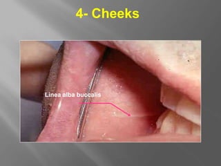 4- Cheeks
Linea alba buccalis
 
