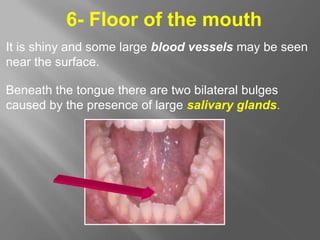 6- Floor of the mouth
It is shiny and some large blood vessels may be seen
near the surface.
Beneath the tongue there are two bilateral bulges
caused by the presence of large salivary glands.
 