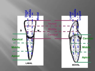 Incisal
Cervical
Cervical
Middle
Middle
Apical
Middle
Mesial
Distal
Cervical
Middle
Apical
Middle
Lingual
Labial
 