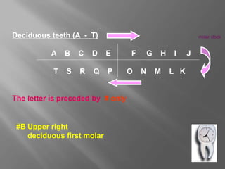 Deciduous teeth (A - T)
A B C D E F G H I J
T S R Q P O N M L K
The letter is preceded by # only
molar clock
#B Upper right
deciduous first molar
 