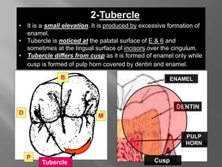 2-Tubercle
• It is a small elevation. It is produced by excessive formation of
enamel.
• Tubercle is noticed at the palatal surface of E & 6 and
sometimes at the lingual surface of incisors over the cingulum.
• Tubercle differs from cusp as it is formed of enamel only while
cusp is formed of pulp horn covered by dentin and enamel.
PULP
HORN
Cusp
ENAMEL
DENTIN
Tubercle
M
B
D
P
 